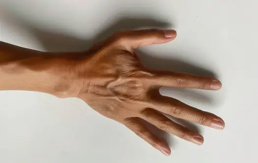 application01-thermograph05-medical diagnosis01